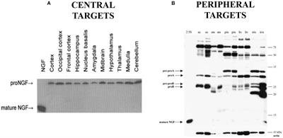 ProNGF and Neurodegeneration in Alzheimer’s Disease